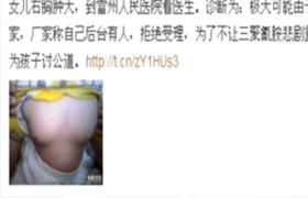 女婴胸发育 父亲指雅培奶粉催"性早熟"