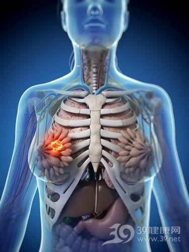 乳腺癌,男人也会得 女人病