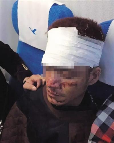 男子飞机洗手间自残场面血腥 航空公司称不追责