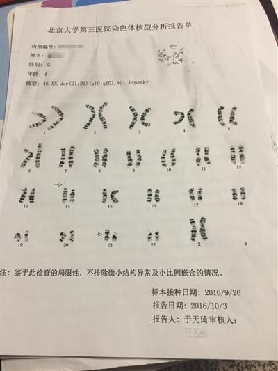 璐璐的染色体核型分析报告单. 新京报记者 赵蕾 摄
