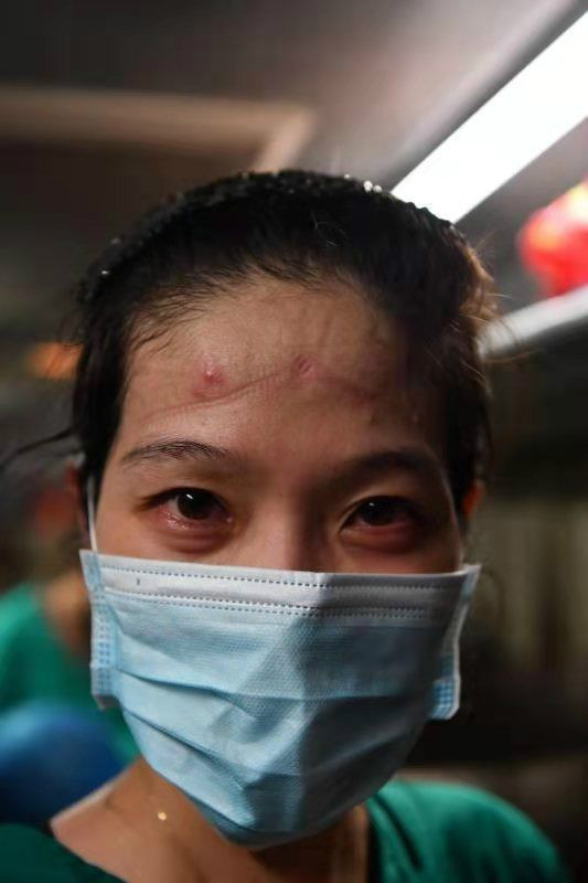 一个个白衣天使 一个个坚定眼神 摘下口罩后的医护人员 尽