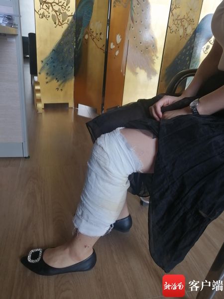 9月16日,王女士左小退至脚踝处还严严实实裹着一层纱布.记者姜飞 摄