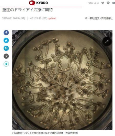 ͼƬԴձͬ籨ͼ